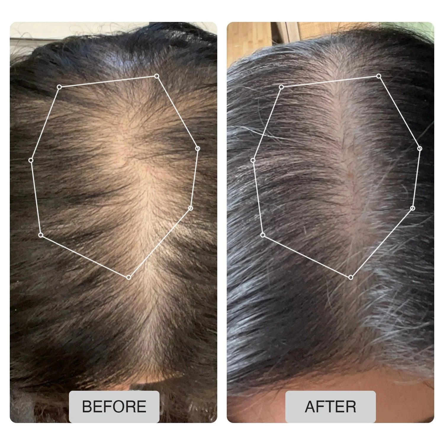 Capillus Spectrum Hair & Scalp Wellness Cap