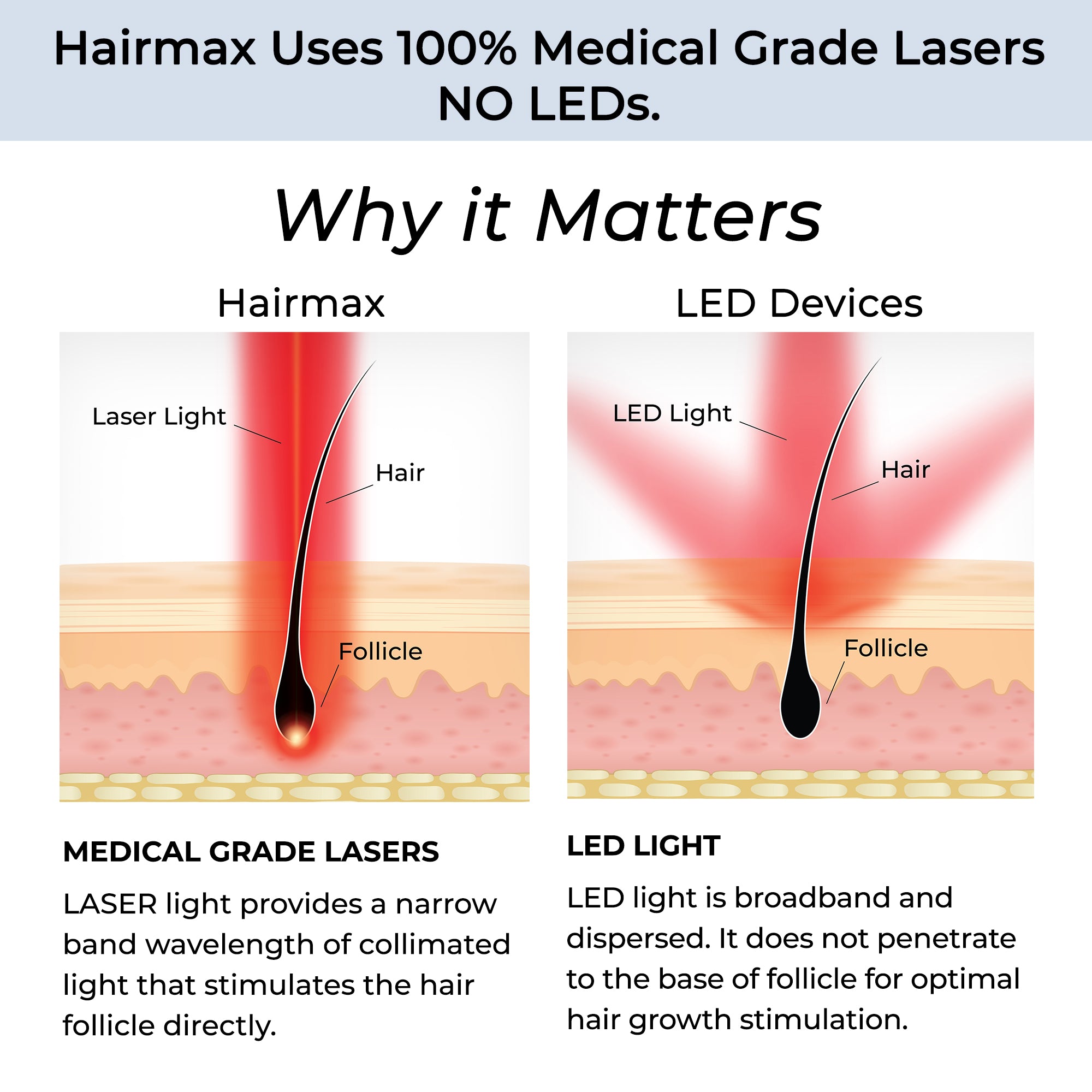 Hairmax LaserBand 82 ComfortFlex